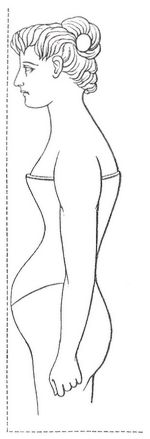 Fig. 2. Körperform bei Schnürung.