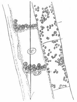 Teil eines Längsschnittes durch einen Knoten von Tradescantia virginica, dessen Längsachse mit der Vertikalen einen Winkel von ca. 13° einschloß. Vgl. Text.