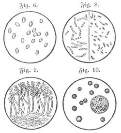Fig. 6. Körperchen 60 0/1. Fig. 8. a Bakterien, b Mikrokkus der schlaffsüchtigen Raupe. 60 0/1. Fig. 9. Pilz der Kalksucht (Botrytis Bassiana). 20 0/1. Fig. 10. Polyedrische Körnchen der Gelb- oder Fettsucht.